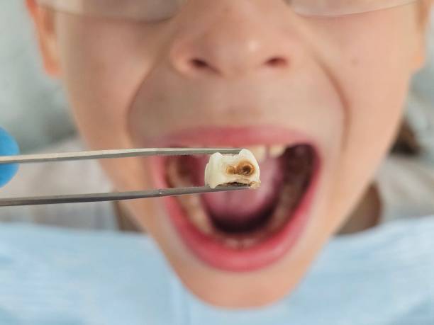 Best Walk-In Emergency Dental Services in Imlay City, MI