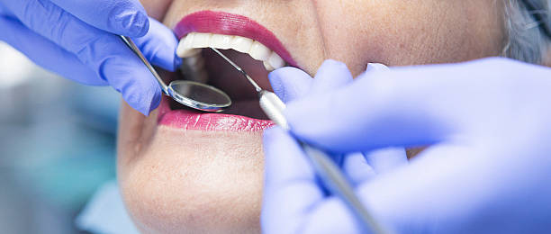 Best Emergency Wisdom Tooth Extraction in Imlay City, MI